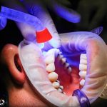 dentist-uv-treatment